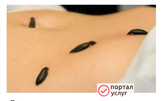 Фото Пиявки
