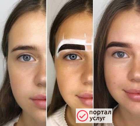 Фото Бровист