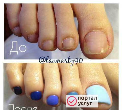 Фото Педикюр
