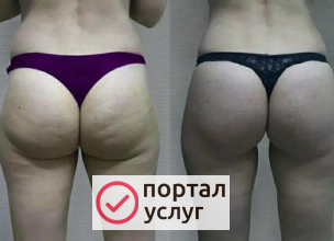 Фото Массаж