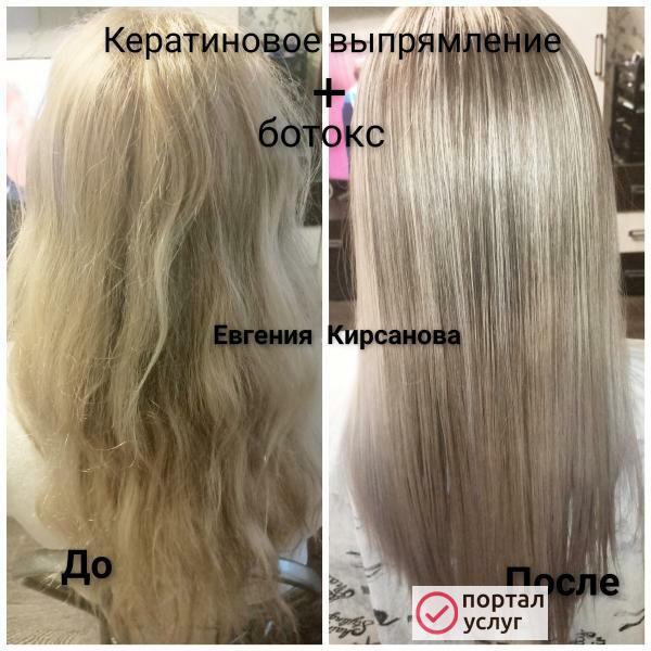 Фото Ботокс 