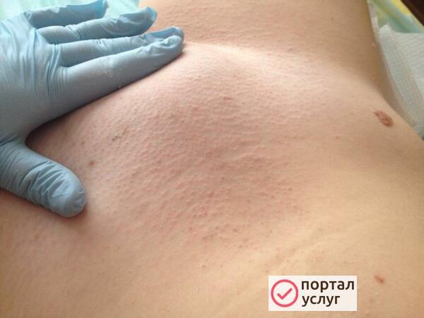 Фото Шугаринг