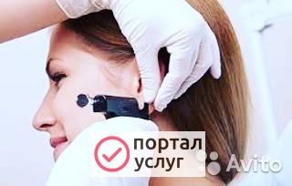 Фото Прокол ушей, медицинские серьги