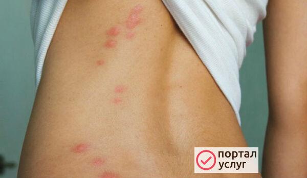 Фото Дезинсекция