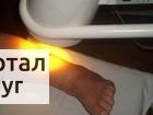 Фото Лечение аппаратом Bioptron РRО