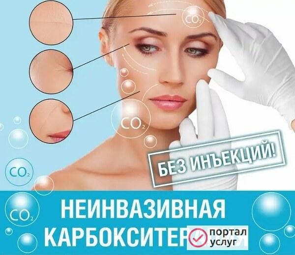 Фото Карбокситерапия безинъекционная