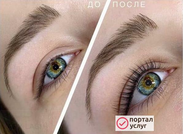 Фото Филлеры / ботокс ресниц
