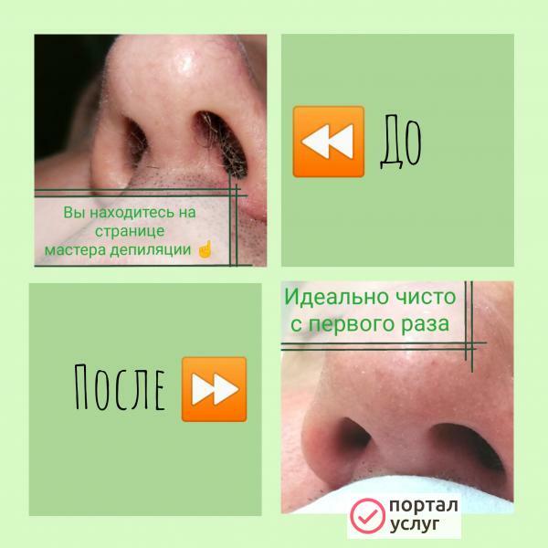 Фото Депиляция. Косметология.