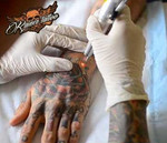 Удаление татуировок в Белгороде