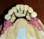 Зуботехническое литьё