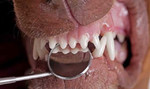 Ультразвуковая чистка зубов без стресса
