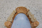 Зубной техник металлокерамист