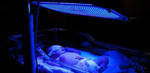 Прокат лампы для лечения желтушки новорождённых