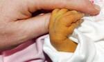 Фотолампа против желтухи новорожденных