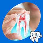 Лечение пульпита 1-канального зуба (вкл. имп. анестезию)