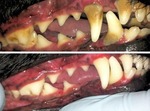 Ультрозвуковая-чистка зубов без боли И наркоза