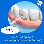 Снятие зубного налета, камня (один зуб