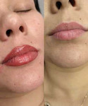 Перманентный макияж бровей, губ, век
