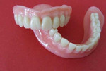 Ремонт зубных протезов (акриловые)