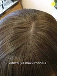 Система замещения волос при алопеции у женщин